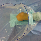 بسته / کیت آرتروسکوپی زانو جراحی یکبار مصرف پزشکی